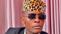 jose-chameleone-undergoes-eye-surgery-following-vision-scare